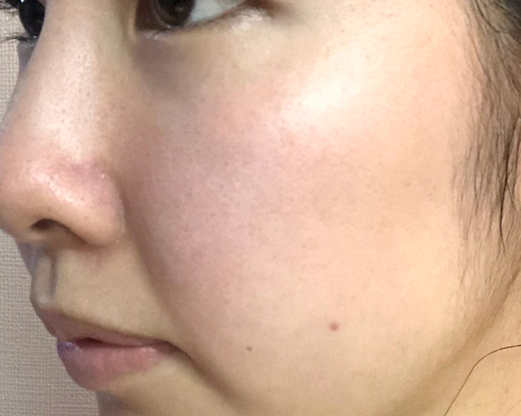 マトリックスエキス　お試し　navis ３日目②